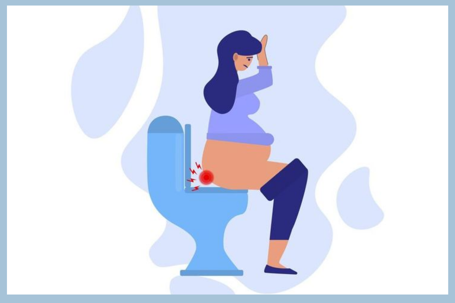 Bệnh trĩ sau sinh: nguyên nhân và cách xử lý an toàn, hiệu quả