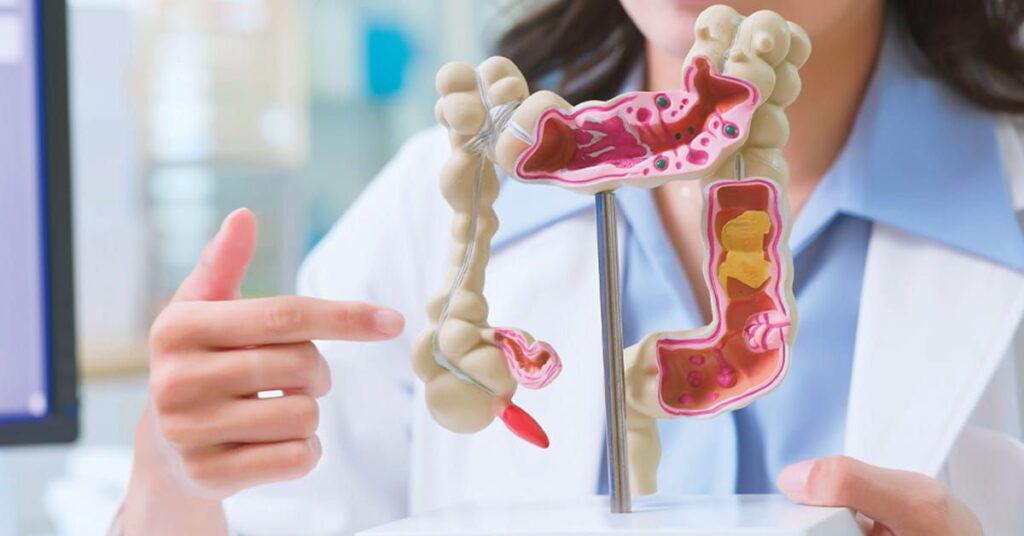 Người trung niên cần chú ý gì để bảo vệ đại trực tràng? 