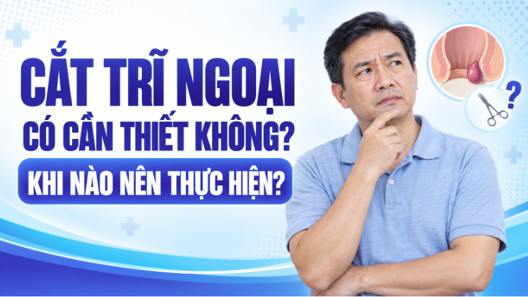 Cắt trĩ ngoại có cần thiết không? Khi nào nên thực hiện? 