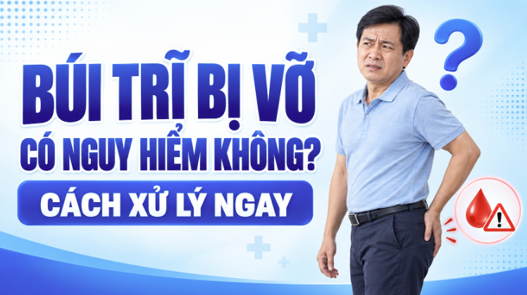 Búi trĩ bị vỡ có nguy hiểm không? Cách xử lý ngay 